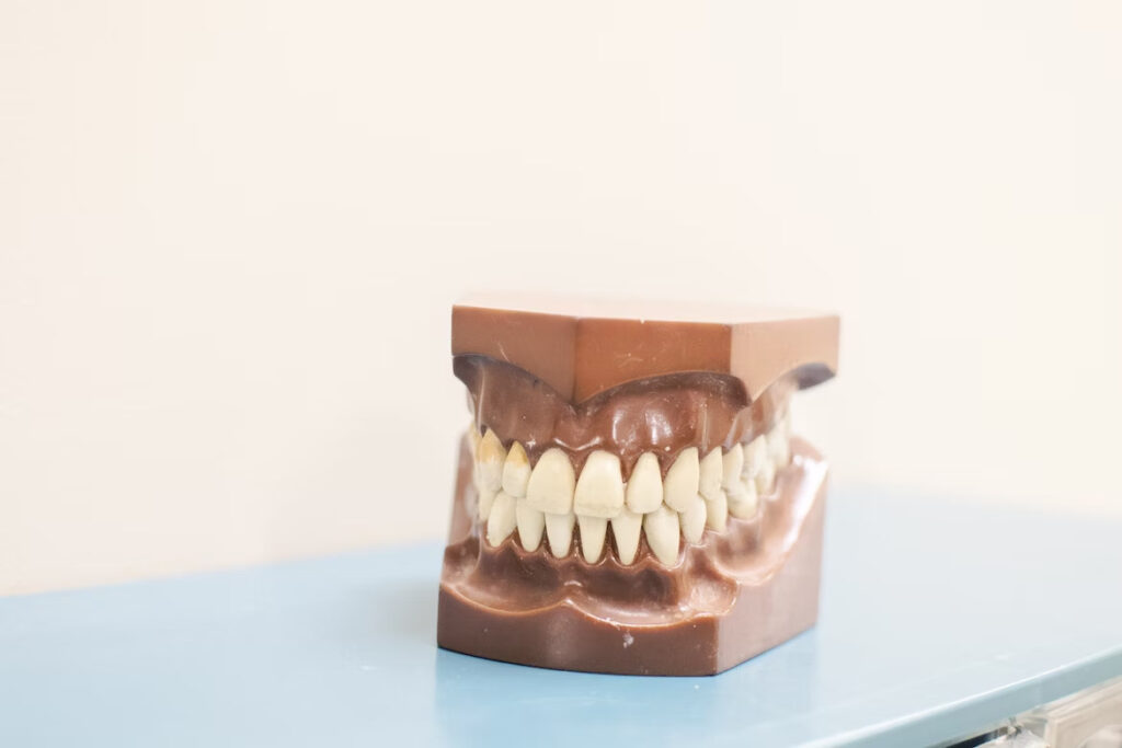 a dental model placed on top of a blue surface