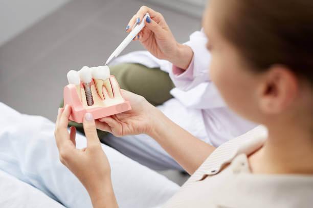 a person holding a tooth model with dental implants