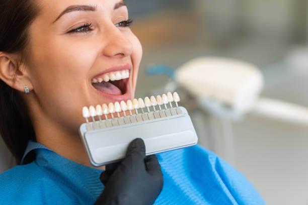 a palette of teeth being compared to a woman's natural teeth